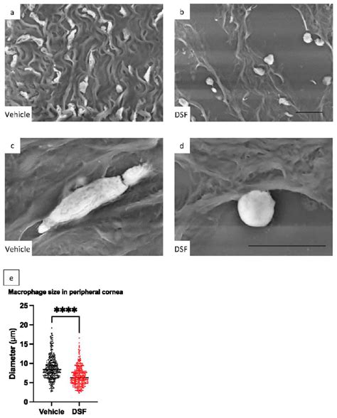 To evaluate pseudopodia formation of macrophages infiltrating the ...