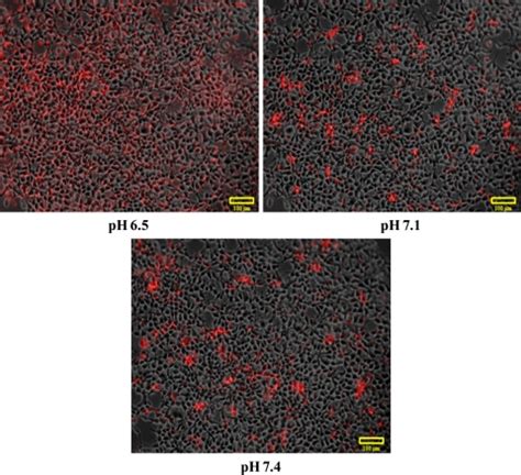 Fluorescence microscope images of HEK 293 cells transfected at... | Download Scientific Diagram