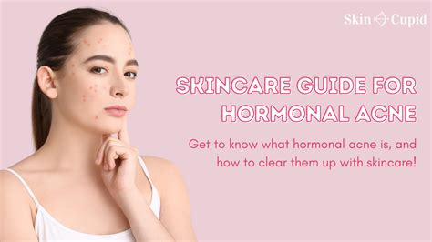 The Hormonal Acne Chronicles Your Skincare Solution Skin Cupid