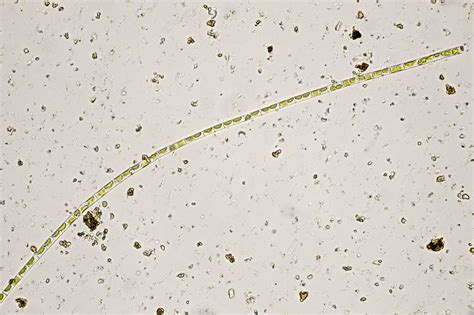 Klebsormidium | The Microscopic Life of Shetland Lochs