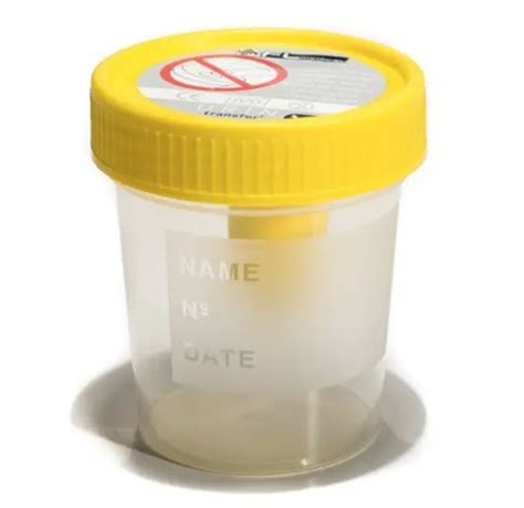 120 Ml Vacuum Urine Container With Yellow Cap Sterile Bulk Packaging