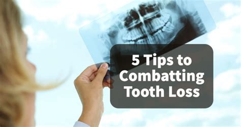 5 Tips To Preventing Tooth Loss In 2022 Phillips And Schmitt Dds Pa