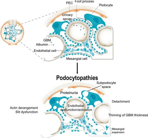 Frontiers Epigenetics And Endoplasmic Reticulum In Podocytopathy