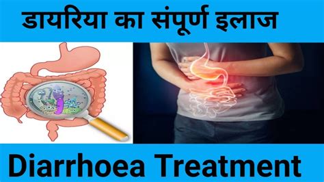 Diarrhoea Treatment In Hindi ।। दस्त का इलाज । Diarrhoea ट्रीटमेंट की