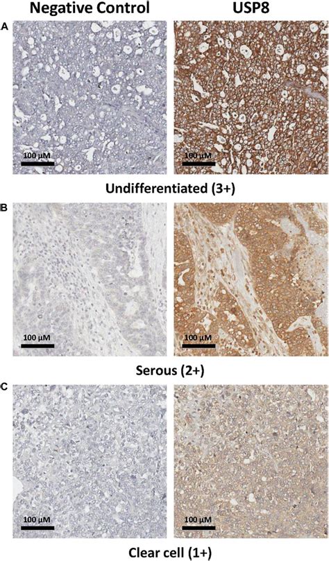 Frontiers The Deubiquitinase USP8 Regulates Ovarian Cancer Cell