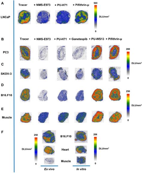 In Vitro Autoradiography In Vitro Autoradiography Of A Lncap B