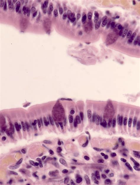 Células caliciformes H E mancia org Atlas Histologia