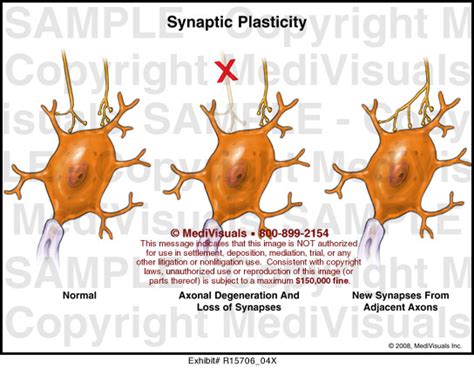 Synaptic Plasticity - MediVisuals