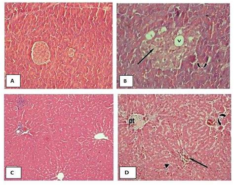 Photomicrographs Of Sections Of A Pancreas Of Control Group Showing