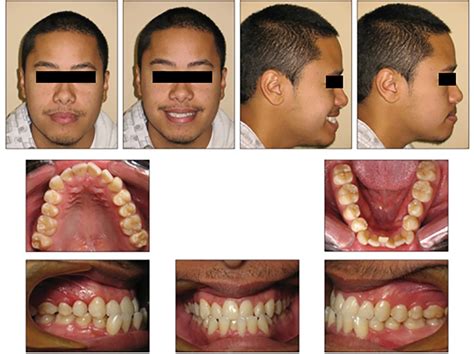 Mair Figure5a Oral Health Group