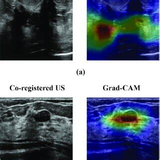 Heat Maps Calculated Using Grad CAM For The Final Convolutional Layer