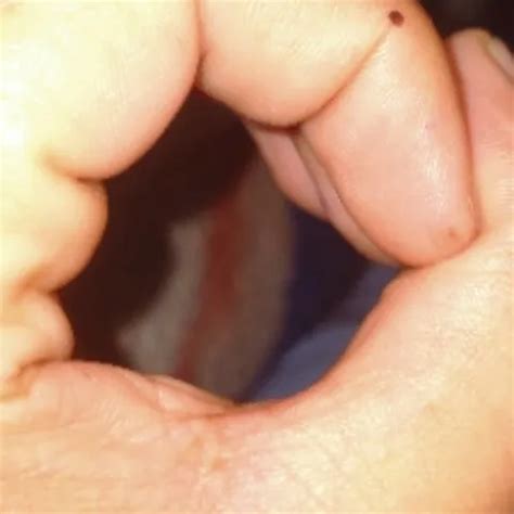 First Time Anal Sex Full Video Gand Faad Chudayi Kuvari Ladki Ne Pahli Bar Gand Me Lud Liya