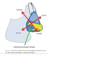 Shield Graft: Septal cartilage (quadrangular cartilage) and the L strut