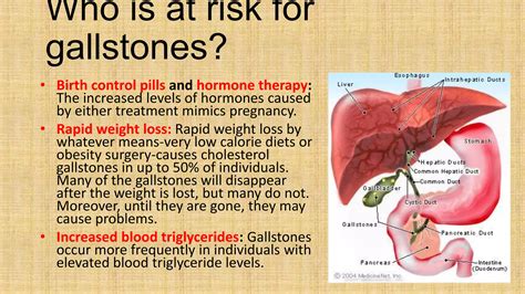 Gall Stone Disease PPT