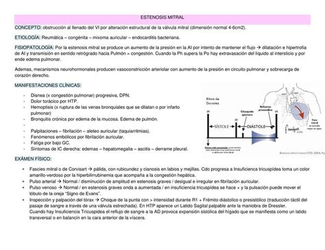 Estenosis E Insuficiencia Mitral RESUMEN Ornella UDocz