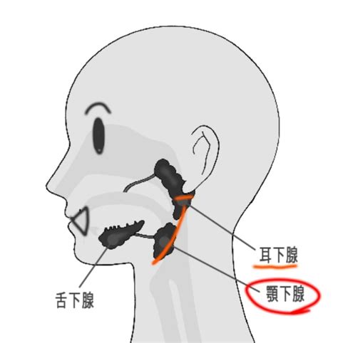 【耳下腺がん】リンパ節転移疑惑の話① いちこさんと子宮体癌と耳下腺癌