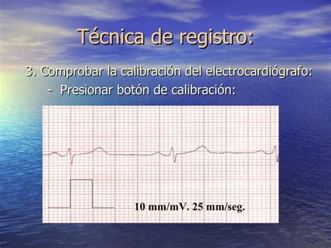 Fisiologia Electrocardiografia Normal Ecg Ppt