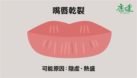 嘴唇發黑發紫是什麼狀況？6種唇色看健康 康健雜誌 Line Today