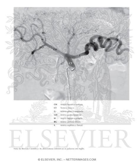 Celiac Arteriogram