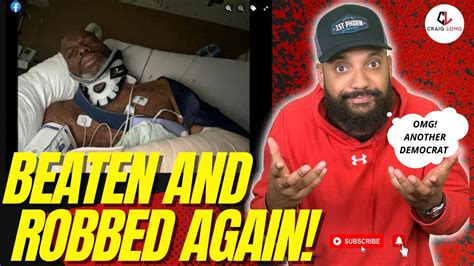 Democratic Mayor Appointee Beaten Robbed Outside His Own Chicago Home And Ends Up In Icu Youtube