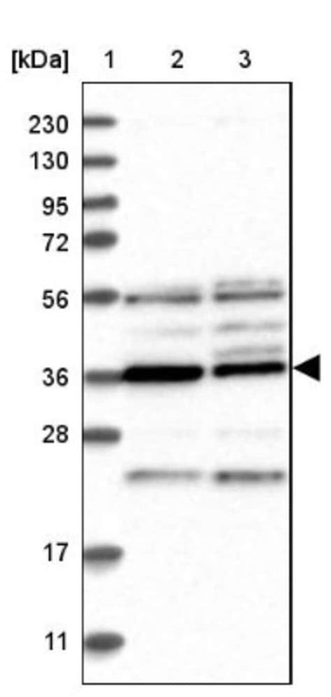 PAK1 Interacting Protein 1 Antibody Novus Biologicals 0 1mL Unlabeled