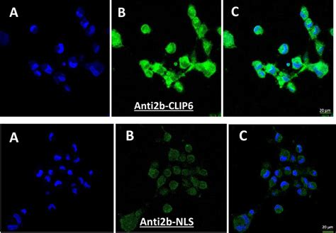 CLSM Images Of U87 MG Glioblastoma Cells Incubated With FITC Labeled