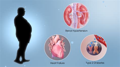 Metabolic Syndrome Shown Using D Medical Animation Still Shot