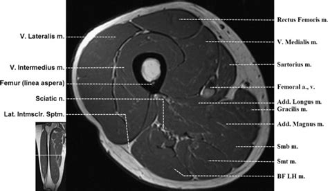 Normal MR Imaging Anatomy of the Thigh and Leg - Magnetic Resonance ...