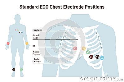 Position Of ECG Chest Leads. Cardiovascular Checkup With Cardiogram. Cartoon Vector ...