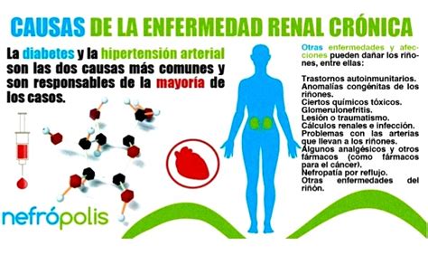 Causas de la insuficiencia renal crónica Vivir mejor