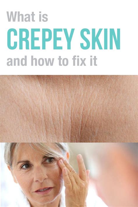 What causes crepey skin and how to fix it – Artofit