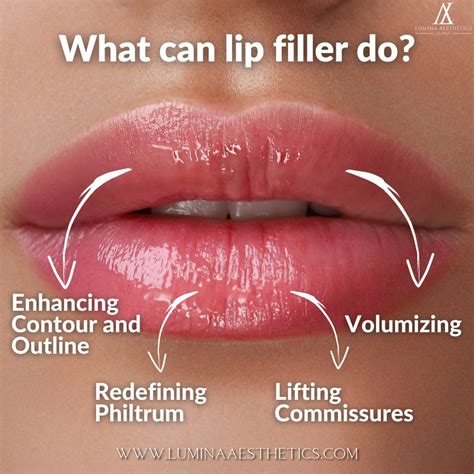 Lumina Aesthetics On Linkedin What Can Lip Filler Do For You Redefine