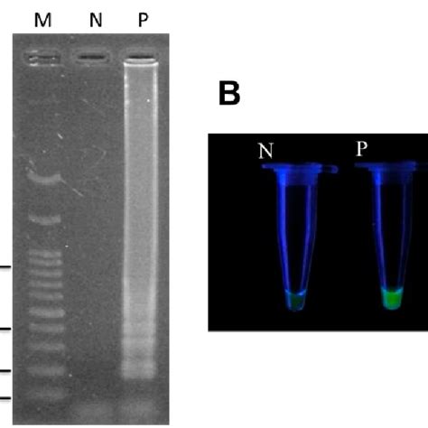 Detection Of The Lamp Products Of T Formosanum Tf Using Dna Download Scientific Diagram