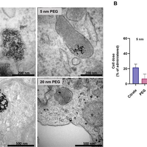 A Tem Of Aunps In Macrophages Taken Following 24 Hours Exposure Of Download Scientific