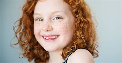 Lupus In Children How Common Is Childhood Lupus