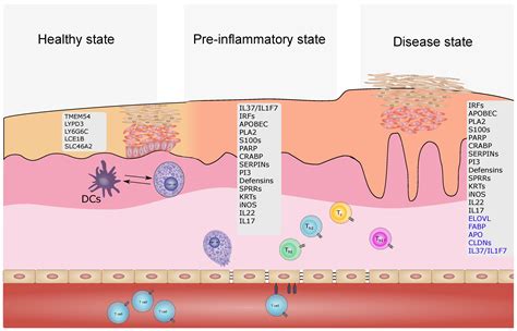 Ijms Free Full Text Reviewcurrent Concepts In Inflammatory Skin