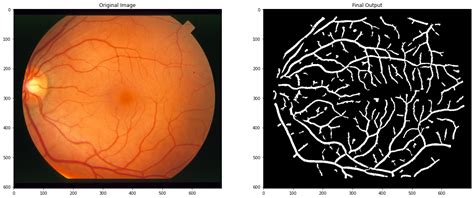 Retinal Vessel Segmentation GithubHelp