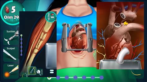 Interactive Open Heart Surgery Learn And Play Open Heart Surgery YouTube