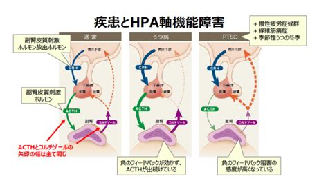 副腎疲労の正体はhpa軸機能異常