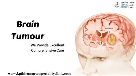 Brain Tumor Surgery In Chennai | Neurosurgeon In India