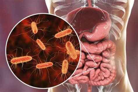 Virus Intestinale cos è la gastroenterite virale Laevolac