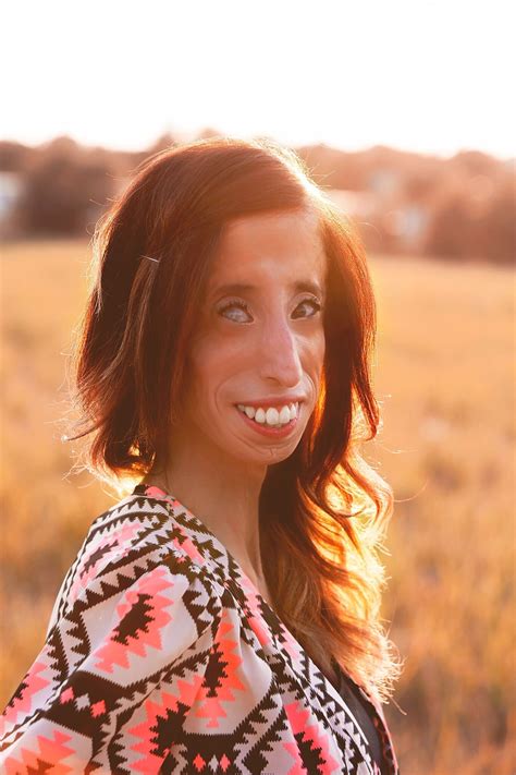 Lizzie Velasquez Fights Bullying With Her New Documentary Fortune