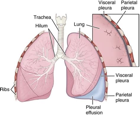 Acute Respiratory Disorders Flashcards Quizlet