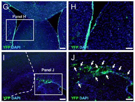 The Fate Of YFP NSPCs Following MCAO Via The Cre LoxP System A J