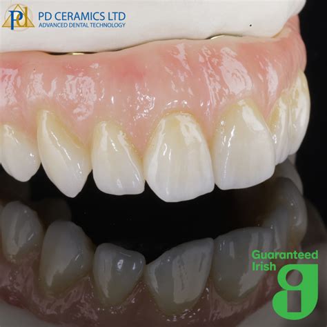 Becoming Guaranteed Irish As A Dental Laboratory Pd Ceramics Ltd