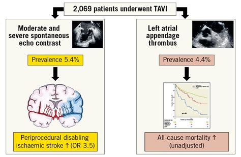 Spontaneous Echo Contrast Left Atrial Appendage Thrombus And Stroke In