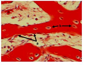 Cancellous Bone Histology Diagram | Quizlet