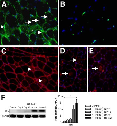 Overexpression Of Mhc Class I In Muscle Of Lymphocyte Deficient Mice