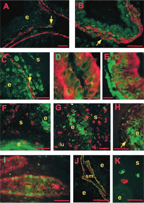 Double Labeled Immunofluorescence Of Rars With Several Cell Markers Was Download Scientific