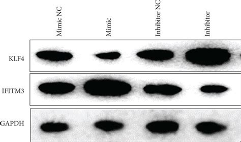 MiR 152 3p Targets KLF4 And Decreases Its Expression A Binding Sites